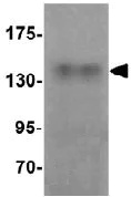 Western blot - Anti-ZMYM3 antibody (AB106626)