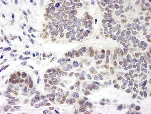 Immunohistochemistry (Formalin/PFA-fixed paraffin-embedded sections) - Anti-ZMYM3 antibody (AB19165)
