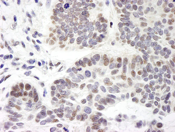 Immunohistochemistry (Formalin/PFA-fixed paraffin-embedded sections) - Anti-ZMYM3 antibody (AB19165)