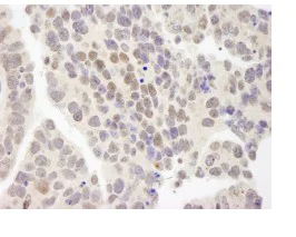 Immunohistochemistry (Formalin/PFA-fixed paraffin-embedded sections) - Anti-ZMYM3 antibody (AB84507)
