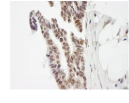 Immunohistochemistry (Formalin/PFA-fixed paraffin-embedded sections) - Anti-ZMYM3 antibody (AB84507)