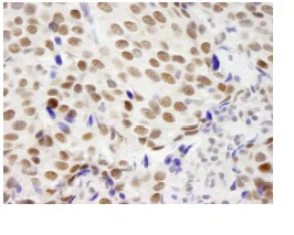 Immunohistochemistry (Formalin/PFA-fixed paraffin-embedded sections) - Anti-ZMYM3 antibody (AB84507)