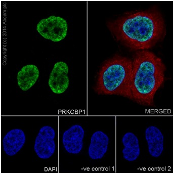 Immunocytochemistry/ Immunofluorescence - Anti-ZMYND8 antibody [EPR16924] (AB201452)