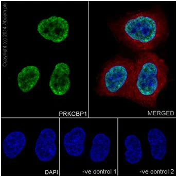 Immunocytochemistry/ Immunofluorescence - Anti-ZMYND8 antibody [EPR16924] - BSA and Azide free (AB232622)