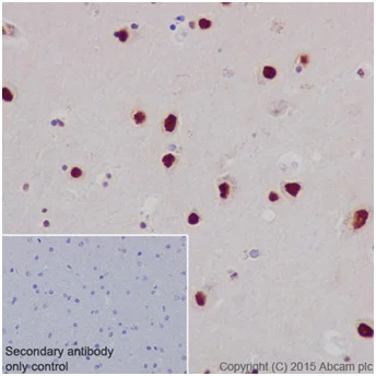 Immunohistochemistry (Formalin/PFA-fixed paraffin-embedded sections) - Anti-ZMYND8 antibody [EPR16924] - BSA and Azide free (AB232622)