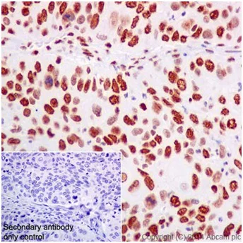 Immunohistochemistry (Formalin/PFA-fixed paraffin-embedded sections) - Anti-ZMYND8 antibody [EPR16924] - BSA and Azide free (AB232622)