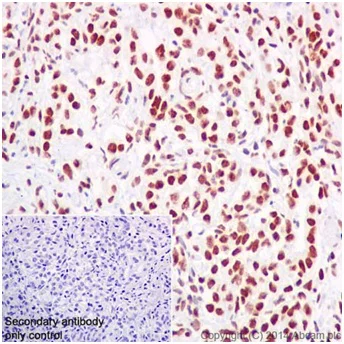 Immunohistochemistry (Formalin/PFA-fixed paraffin-embedded sections) - Anti-ZMYND8 antibody [EPR16924] - BSA and Azide free (AB232622)