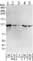 Western blot - Anti-ZNF148 antibody (AB112058)