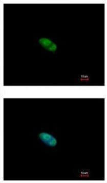 Immunocytochemistry/ Immunofluorescence - Anti-ZNF148 antibody (AB227076)