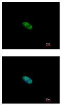 Immunocytochemistry/ Immunofluorescence - Anti-ZNF148 antibody (AB227076)