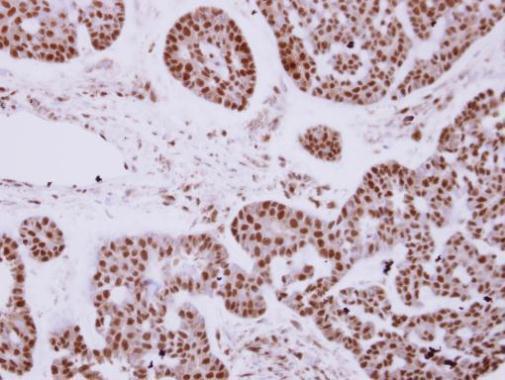 Immunohistochemistry (Formalin/PFA-fixed paraffin-embedded sections) - Anti-ZNF148 antibody (AB227076)