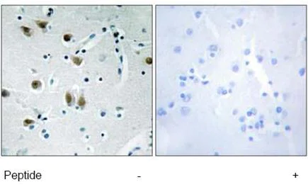 Immunohistochemistry (Formalin/PFA-fixed paraffin-embedded sections) - Anti-ZNF148 antibody (AB69933)