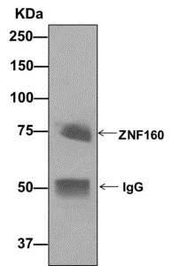Immunoprecipitation - Anti-ZNF160 antibody [EPR12523] - BSA and Azide free (AB249878)
