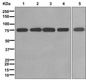 Western blot - Anti-ZNF160 antibody [EPR12523] - BSA and Azide free (AB249878)