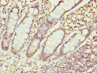 Immunohistochemistry (Formalin/PFA-fixed paraffin-embedded sections) - Anti-ZNF169 antibody (AB225924)