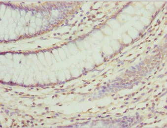Immunohistochemistry (Formalin/PFA-fixed paraffin-embedded sections) - Anti-ZNF169 antibody (AB225924)