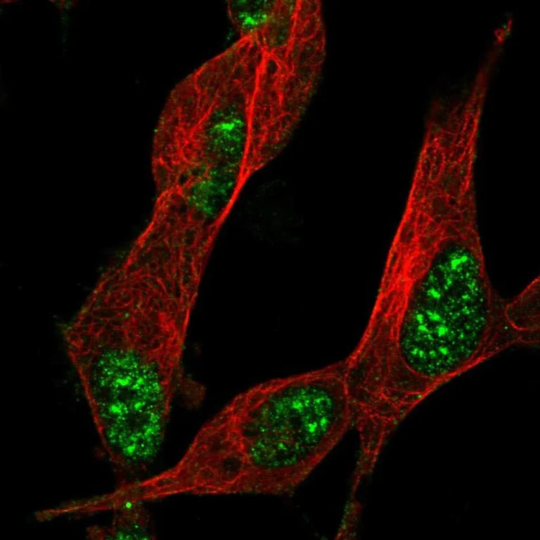 Immunocytochemistry/ Immunofluorescence - Anti-ZNF179/BFP antibody (AB246912)