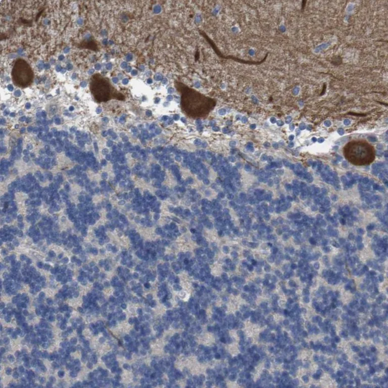 Immunohistochemistry (Formalin/PFA-fixed paraffin-embedded sections) - Anti-ZNF179/BFP antibody (AB246912)