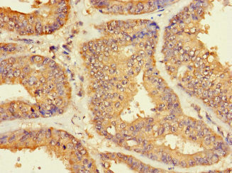 Immunohistochemistry (Formalin/PFA-fixed paraffin-embedded sections) - Anti-ZNF2 antibody (AB222833)