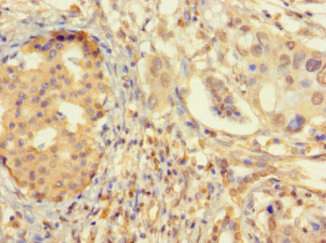 Immunohistochemistry (Formalin/PFA-fixed paraffin-embedded sections) - Anti-ZNF2 antibody (AB222833)