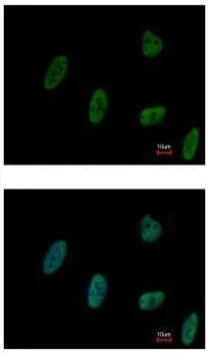 Immunocytochemistry/ Immunofluorescence - Anti-ZNF207/BUGZ antibody (AB228926)