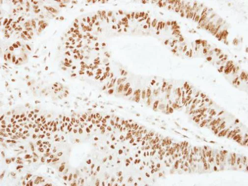 Immunohistochemistry (Formalin/PFA-fixed paraffin-embedded sections) - Anti-ZNF207/BUGZ antibody (AB228926)