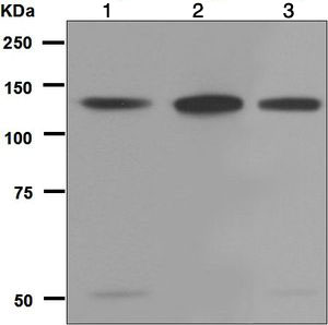 Western blot - Anti-ZNF217 antibody [EPR6362] (AB124927)