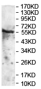 Western blot - Anti-ZNF238 antibody (AB118471)