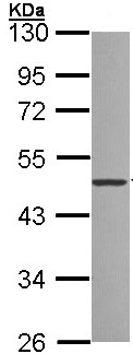 Western blot - Anti-ZNF277 antibody (AB96299), expandable thumbnail