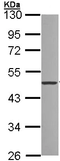 Western blot - Anti-ZNF277 antibody (AB96299)