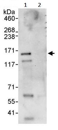Immunoprecipitation - Anti-ZNF295 antibody (AB241956)
