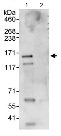 Immunoprecipitation - Anti-ZNF295 antibody (AB241956)