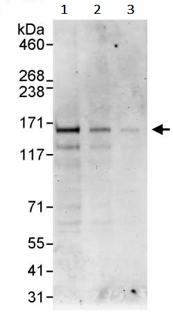 Western blot - Anti-ZNF295 antibody (AB241956)