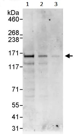 Western blot - Anti-ZNF295 antibody (AB241956)