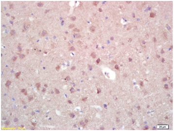 Immunohistochemistry (Formalin/PFA-fixed paraffin-embedded sections) - Anti-ZNF300 antibody (AB202965)