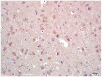 Immunohistochemistry (Formalin/PFA-fixed paraffin-embedded sections) - Anti-ZNF300 antibody (AB202965)