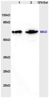 Western blot - Anti-ZNF300 antibody (AB202965)
