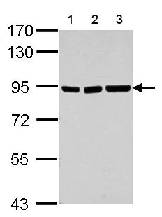 Western blot - Anti-ZNF31 antibody (AB127196)