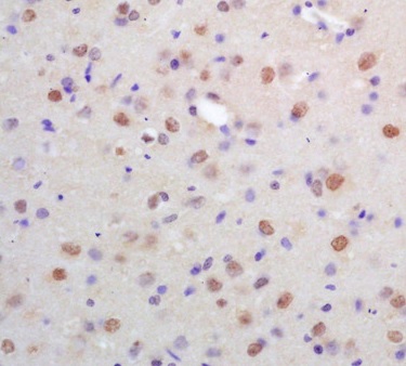 Immunohistochemistry (Formalin/PFA-fixed paraffin-embedded sections) - Anti-ZNF312/FEZF2 antibody (AB214186)