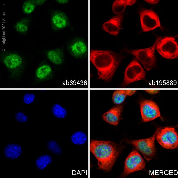 Immunocytochemistry/ Immunofluorescence - Anti-ZNF312/FEZF2 antibody (AB69436), expandable thumbnail
