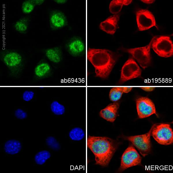 Immunocytochemistry/ Immunofluorescence - Anti-ZNF312/FEZF2 antibody (AB69436)
