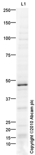 Western blot - Anti-ZNF312/FEZF2 antibody (AB69436), expandable thumbnail
