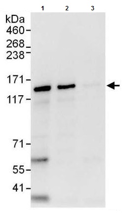 Immunoprecipitation - Anti-ZNF316 antibody (AB176708), expandable thumbnail
