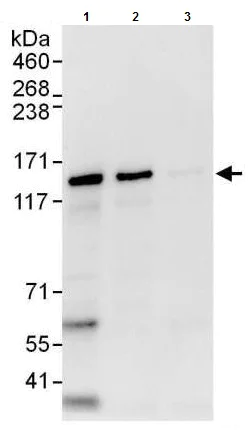 Immunoprecipitation - Anti-ZNF316 antibody (AB176708)