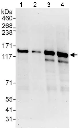 Western blot - Anti-ZNF316 antibody (AB176708)