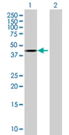 Western blot - Anti-ZNF331 antibody (AB67886)
