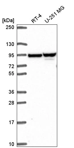 Western blot - Anti-ZNF341 antibody (AB272679)