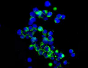 Immunocytochemistry/ Immunofluorescence - Anti-ZNF365 antibody [EPR10216] - BSA and Azide free (AB249328), expandable thumbnail