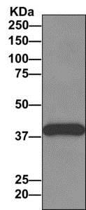 Immunoprecipitation - Anti-ZNF365 antibody [EPR10216] - BSA and Azide free (AB249328), expandable thumbnail