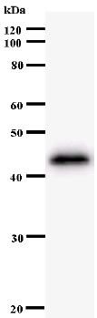 Western blot - Anti-ZNF384 antibody [3545C5a] (AB54360)
